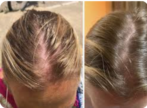 Daily Scalp Tonic