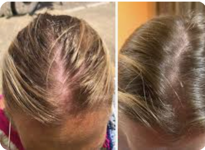 Daily Scalp Tonic