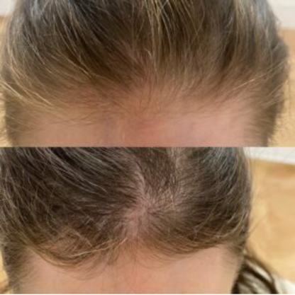 Daily Scalp Tonic